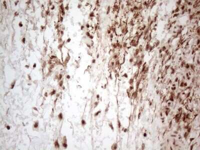 Immunohistochemistry: IRS1 Antibody (OTI3G10) [NBP2-45435]