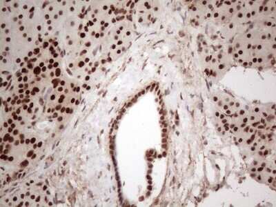 Immunohistochemistry: IRS1 Antibody (OTI3G10) [NBP2-45435]