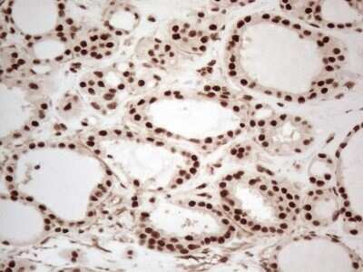 Immunohistochemistry: IRS1 Antibody (OTI3G10) [NBP2-45435]