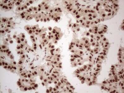Immunohistochemistry: IRS1 Antibody (OTI3G10) [NBP2-45435]