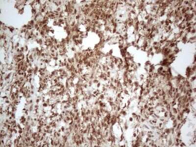 Immunohistochemistry: IRS1 Antibody (OTI3G10) [NBP2-45435]