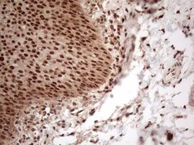 Immunohistochemistry: IRS1 Antibody (OTI3G10) [NBP2-45435]