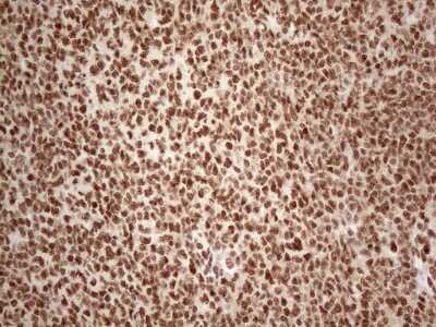 Immunohistochemistry: IRS1 Antibody (OTI3G10) [NBP2-45435]