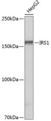 Western Blot: IRS1 Antibody (3Q8A2) [NBP3-15648]