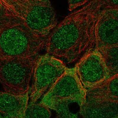 Immunocytochemistry/ Immunofluorescence: IRS1 Antibody [NBP2-68666]