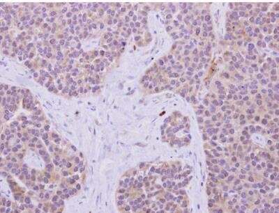 Immunohistochemistry-Paraffin: IRS1 Antibody [NBP2-16992]