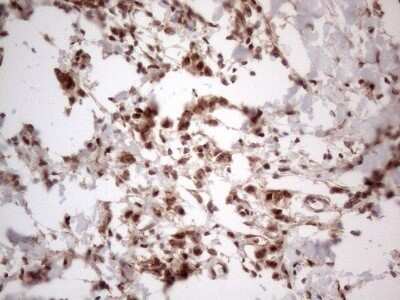 Immunohistochemistry: IRS1 Antibody (OTI3G10) - Azide and BSA Free [NBP2-71049]