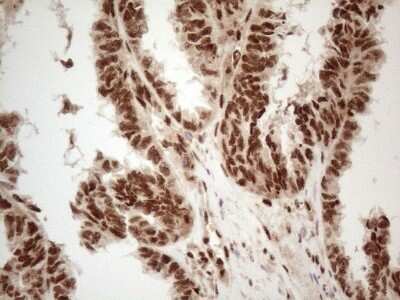 Immunohistochemistry: IRS1 Antibody (OTI3G10) - Azide and BSA Free [NBP2-71049]
