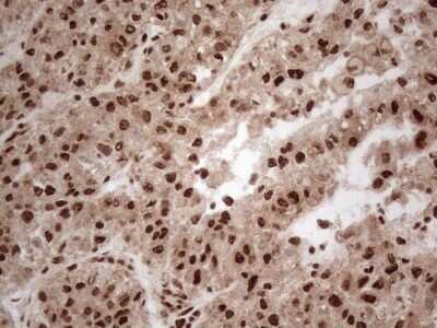 Immunohistochemistry: IRS1 Antibody (OTI3G10) - Azide and BSA Free [NBP2-71049]