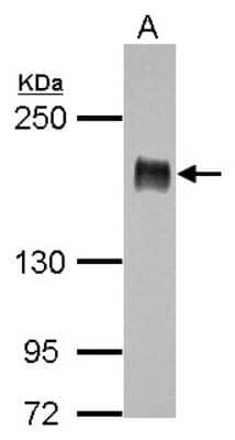 Western Blot: IRS1 Antibody [NBP2-16992]