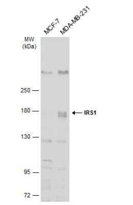 Western Blot: IRS1 Antibody [NBP2-16992]