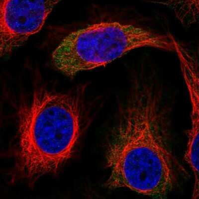 Immunocytochemistry/ Immunofluorescence: IRS2 Antibody [NBP2-56211]