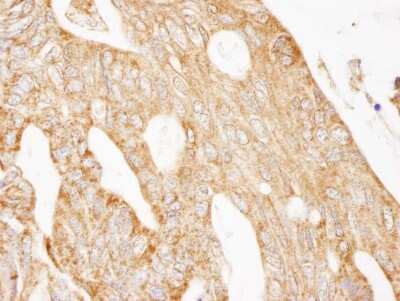 Immunohistochemistry-Paraffin: IRS2 Antibody [NB100-68244]