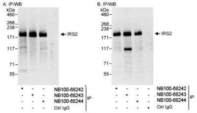 Immunoprecipitation: IRS2 Antibody [NB100-68244]