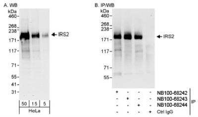 Western Blot: IRS2 Antibody [NB100-68242]