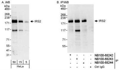 Western Blot: IRS2 Antibody [NB100-68243]