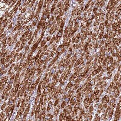 Immunohistochemistry: IRS4 Antibody [NBP2-14130]