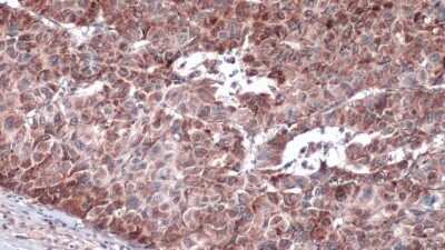 Immunohistochemistry-Paraffin: IRS4 Antibody [NBP3-12966]