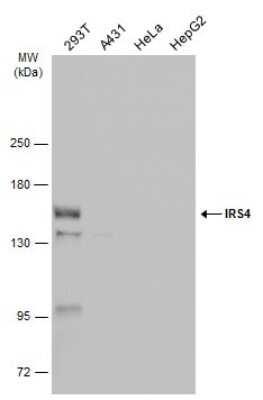 Western Blot: IRS4 Antibody [NBP3-12966]