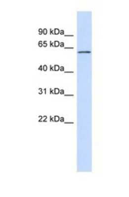 Western Blot: FCRL4/FcRH4/IRTA1 Antibody [NBP1-69383]