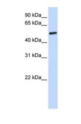 Western Blot: FCRL4/FcRH4/IRTA1 Antibody [NBP1-69384]