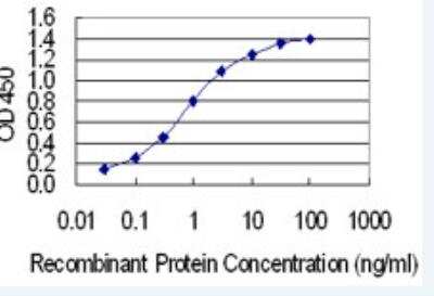 ELISA: IRX1 Antibody (1A11) [H00079192-M04-100ug]