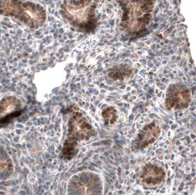 Immunohistochemistry-Paraffin: IRX1 Antibody [NBP1-83090]
