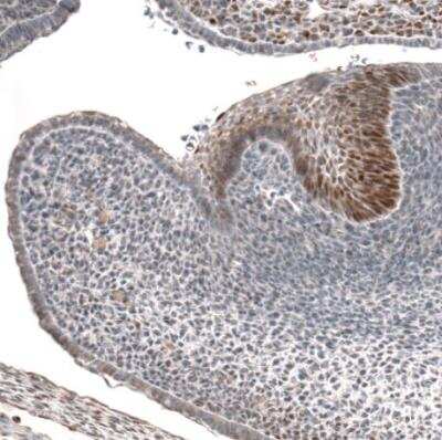 Immunohistochemistry-Paraffin: IRX1 Antibody [NBP1-83090]
