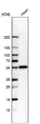 Western Blot: IRX1 Antibody [NBP1-83090]