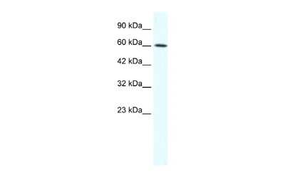 Western Blot: IRX1 Antibody [NBP2-85105]