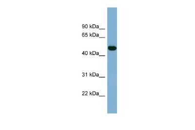 Western Blot: IRX1 Antibody [NBP2-85108]