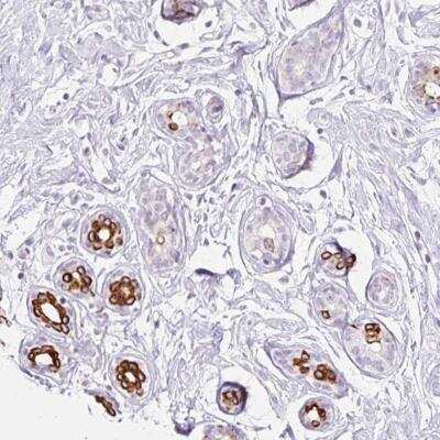 Immunohistochemistry-Paraffin: IRX2 Antibody [NBP2-49143]