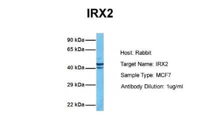 Western Blot: IRX2 Antibody [NBP2-85111]