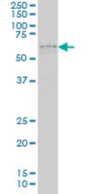 Western Blot: IRX3 Antibody (2H3) [H00079191-M08]