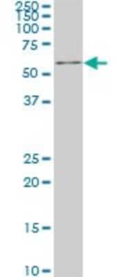 Western Blot: IRX3 Antibody (3D8) [H00079191-M03]