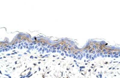 Immunohistochemistry: IRX3 Antibody [NBP3-10552]