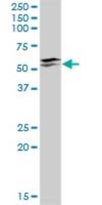 Western Blot: IRX3 Antibody [H00079191-D01P]