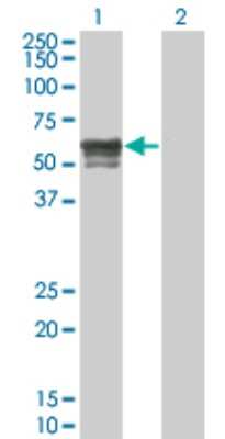 Western Blot: IRX6 Antibody (1A5) [H00079190-M01]