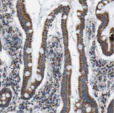 Immunohistochemistry-Paraffin: IRX6 Antibody [NBP1-81581]