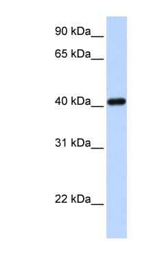 Western Blot: IRX6 Antibody [NBP1-79257]