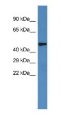 Western Blot: IRX6 Antibody [NBP1-79258]