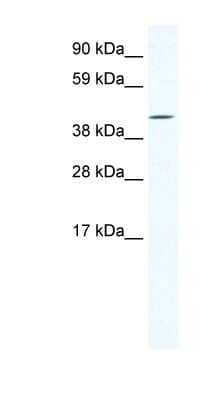 Western Blot: IRX6 Antibody [NBP1-80245]