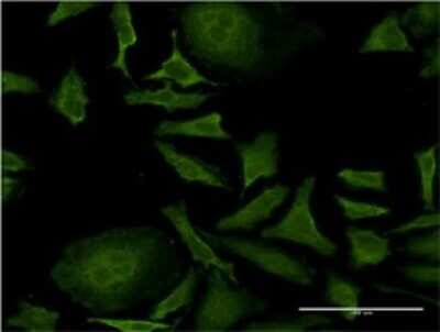 Immunocytochemistry/ Immunofluorescence: ISCU Antibody (3D12-1D10) [H00023479-M02]