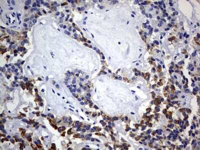Immunohistochemistry: ISCU Antibody (OTI4F5) [NBP2-45436]