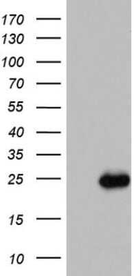 Western Blot: ISCU Antibody (OTI4F5) [NBP2-45436]