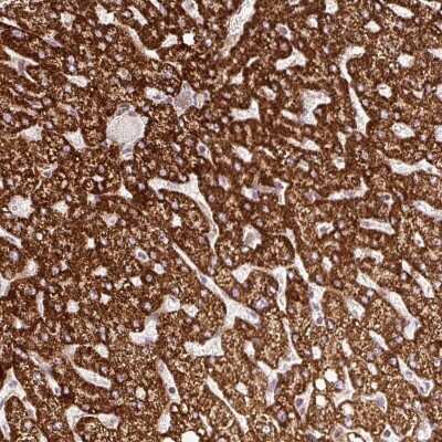 Immunohistochemistry: ISCU Antibody [NBP2-38420]