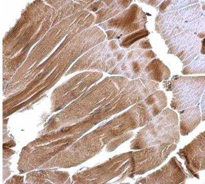 Immunohistochemistry-Paraffin: ISCU Antibody [NBP2-14998]