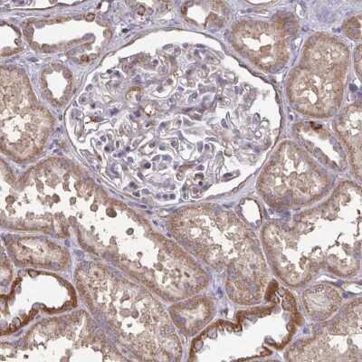 Immunohistochemistry-Paraffin: ISCU Antibody [NBP2-38829]
