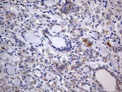 Immunohistochemistry: ISCU Antibody (OTI4F5) - Azide and BSA Free [NBP2-71742]