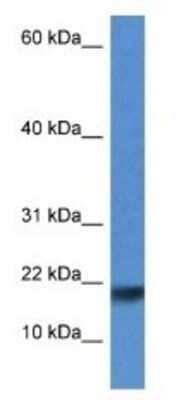 Western Blot: ISCU Antibody [NBP1-74072]